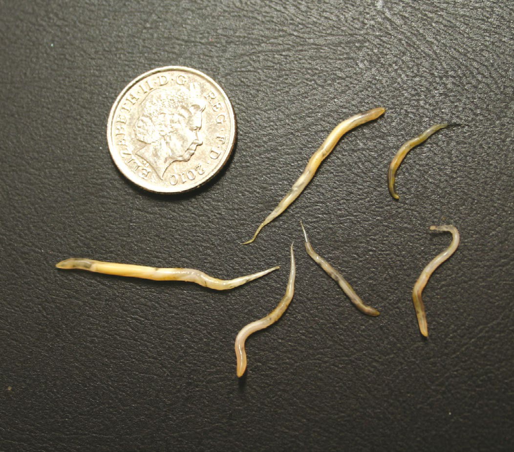 Pinworms Nhs