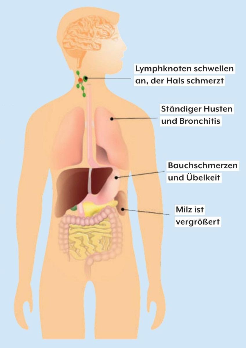 WENN KÜSSEN KRANK MACHT